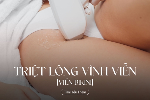 Triệt lông viền bikini vĩnh viễn